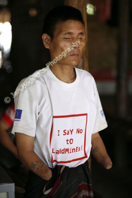 Thailand, Vluchtelingenkamp Mae La, februari-maart 2008Slachtoffers van landmijnenSaw Pa Taw verblijft dagelijks in de Care Villa van de Karen Handicap Association Met hem is een interview (op video opgenomen)